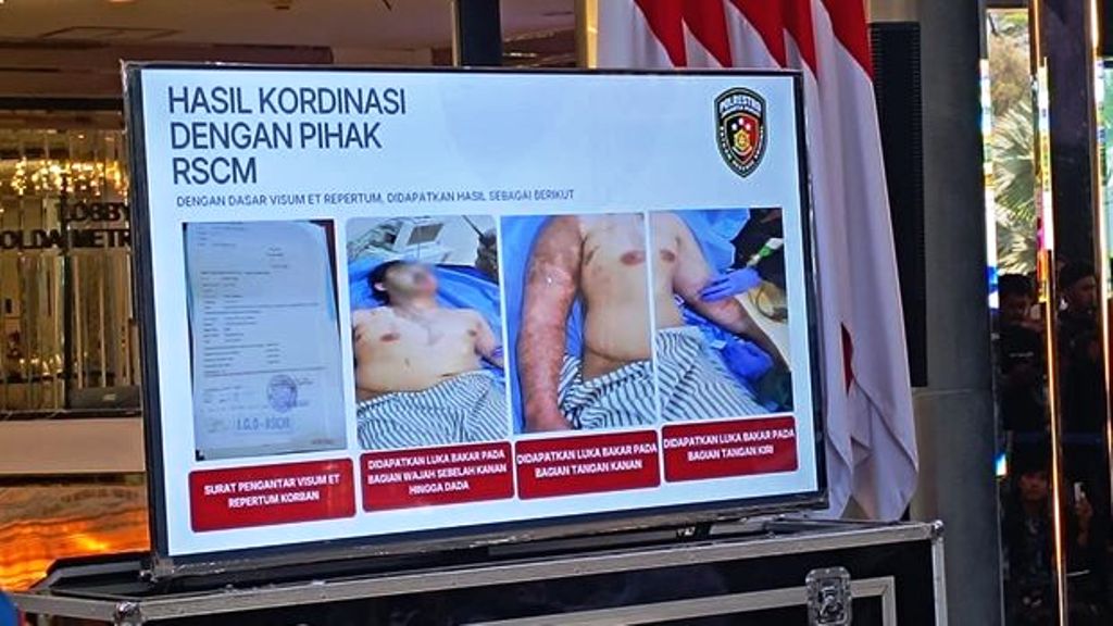 Kondisi Terbaru Aktivis KontraS: Komplikasi-Jalani Operasi Lanjutan