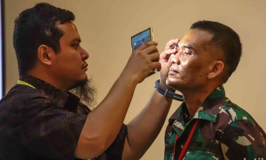 Cacat Permanen, Aktivis KontraS yang Disiram Air Keras Hanya Bisa Lihat Cahaya